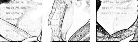 天津菲丝澜医疗美容党涛隆胸介绍片较新分享_1个多月鼻子就比较自然啦,看下怎么样吧!