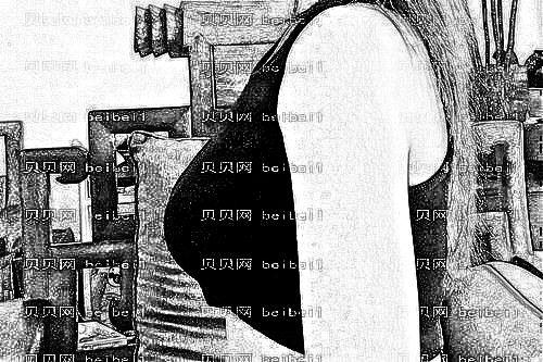天津华夏医院韩式整形美容科袁超英隆胸案例图片最新分享_真人自述恢复日记公开