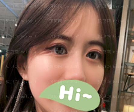 天津解放军四六四医院整形美容科付伟娜祛斑介绍片较新分享_皮肤好了气质也提升啦!