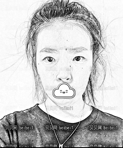 天津乐园医院医学美容整形中心欧阳武医生假体隆鼻介绍片较新分享_术后果敲自然哦!