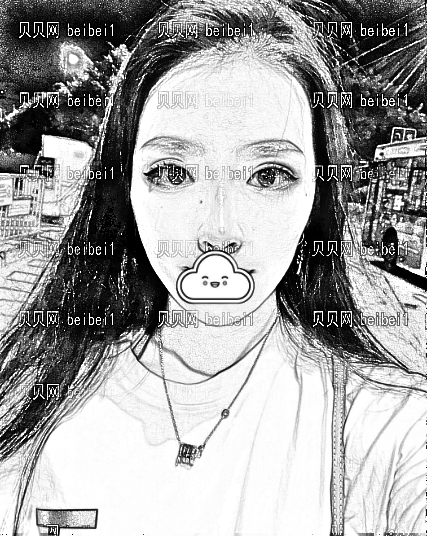 天津乐园医院医学美容整形中心欧阳武医生假体隆鼻介绍片较新分享_术后果敲自然哦!