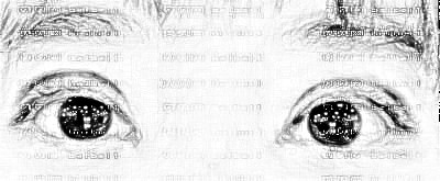 天津乐园医院医学美容整形中心孙天真双眼皮整形介绍片较新分享_来聊聊做了眼睛的亲身感受!