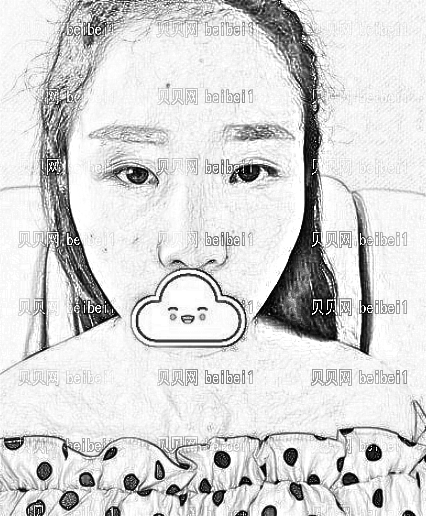 天津乐园医院医学美容整形中心王立刚眼部手术介绍片较新分享_看看我的的双眼皮蜕变经历吧!