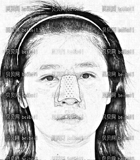 天津欧菲整形美容医院梁海元鼻部手术介绍片较新分享_不看后悔系列(果就是这么好的啦)!
