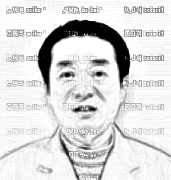 天津欧菲整形美容医院王世宏自体脂肪填充泪沟介绍片较新分享_变美就是这么简单！
