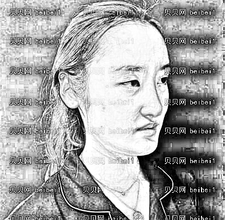 天津欧菲整形美容医院王世宏自体脂肪填充泪沟介绍片较新分享_变美就是这么简单！