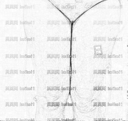 天津欧菲整形美容医院王世宏吸脂瘦腿介绍片较新分享_吸脂咋样/看看我的恢复过程吧!