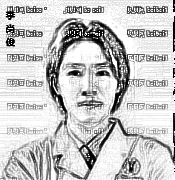 天津欧菲整形美容医院李尚俊假体隆鼻介绍片较新分享_鼻子很漂亮，很立体了哦！