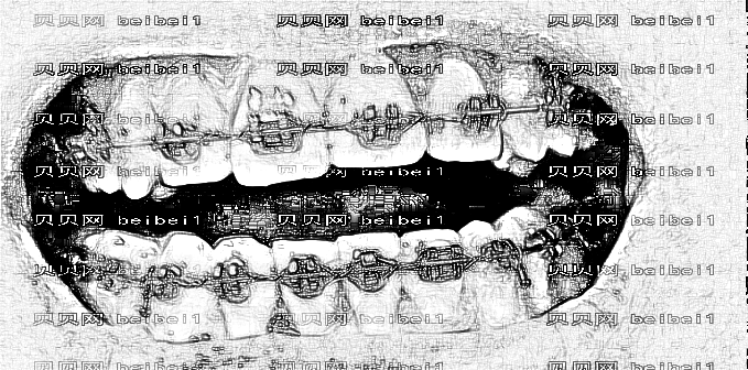 天津欧菲整形美容医院贺永奎矫正牙齿介绍片较新分享_牙齿蜕变史