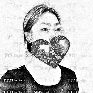 天津欧菲整形美容医院陈娇割双眼皮介绍片较新分享_一甩往日丑眼之态!