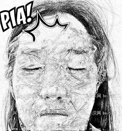 天津欧菲整形美容医院唐婷婷祛斑介绍片较新分享_恢复果不一般哦!