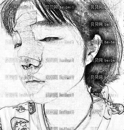 天津欧菲整形美容医院张剑锋鼻部手术介绍片较新分享_看看恢复后的鼻子果怎么样？