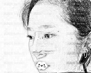 天津欧菲整形美容医院张剑锋假体隆鼻介绍片较新分享_这个鼻型你喜欢吗？