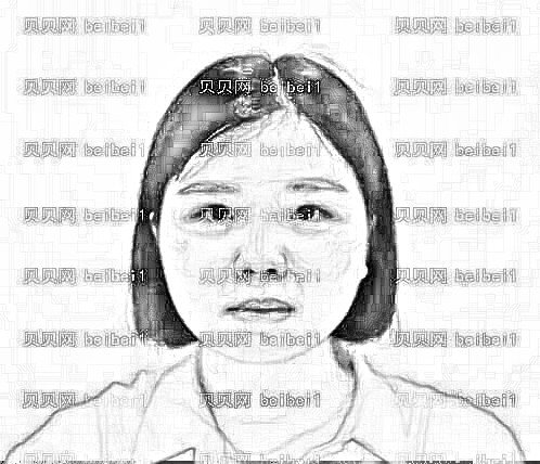 天津欧菲整形美容医院赵洁祛斑介绍片较新分享_终于摆脱了我的雀斑!