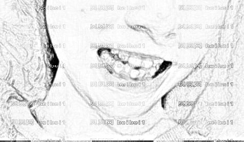 天津欧菲整形美容医院好隐形托槽矫正介绍片较新分享_看下整了后的牙齿好看不？