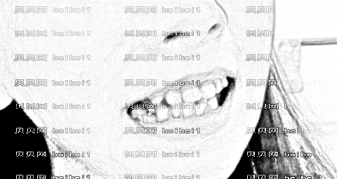 天津欧菲整形美容医院好隐形托槽矫正介绍片较新分享_看下整了后的牙齿好看不？