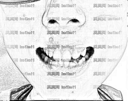 天津欧菲整形美容医院好矫正牙齿介绍片较新分享_我的整牙记录