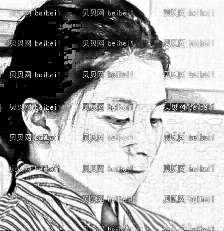 天津欧菲整形美容医院闫腾元鼻部手术介绍片较新分享_隆鼻蜕变记