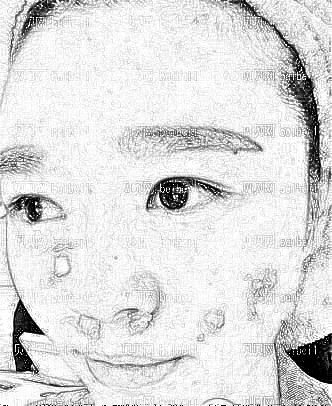 天津美莱医学美容医院余志敏祛斑手术介绍片较新分享_皮肤蜕变记录心得分享