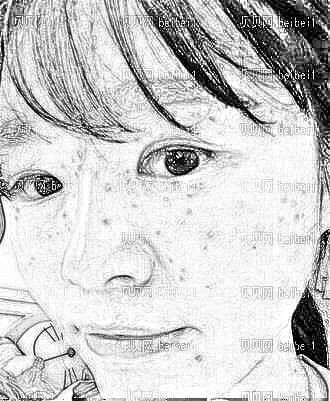 天津美莱医学美容医院余志敏祛斑手术介绍片较新分享_皮肤蜕变记录心得分享
