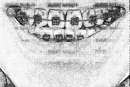 天津美莱医学美容医院乔乐矫正牙齿介绍片较新分享_正牙恢复记录公开