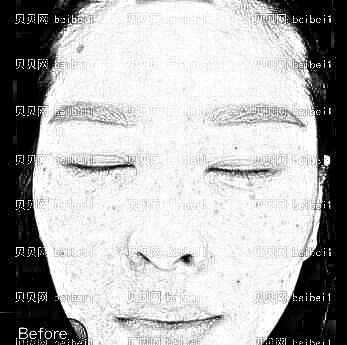 天津美莱医学美容医院汪奇志综合祛斑调节介绍片较新分享_斑点消失得无影无踪啦！