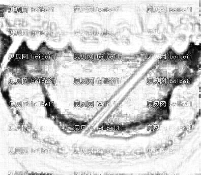 天津美莱医学美容医院高志永牙齿矫正介绍片较新分享_果然牙齿正了颜值更好看了！
