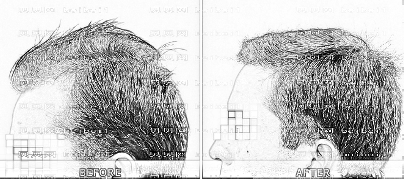 成都丝缘植发怎么样?哪个医生技术好