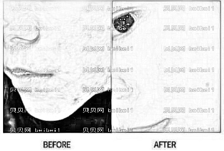 福州久植因美整形医院怎么样?医生排名