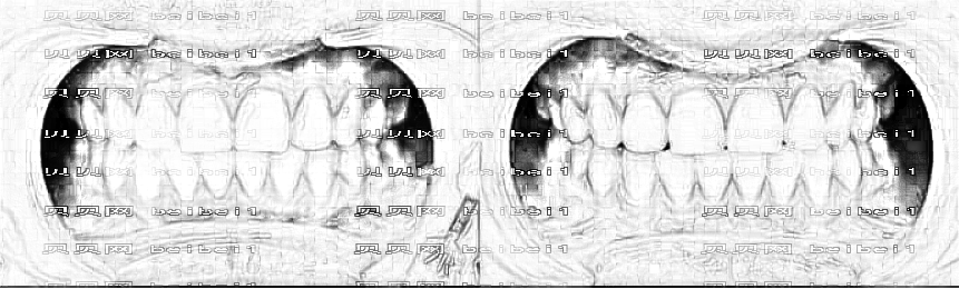 兰州康美口腔医院怎么样?哪个医生技术好