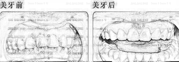昆明拜博口腔医院怎么样?哪个医生技术好