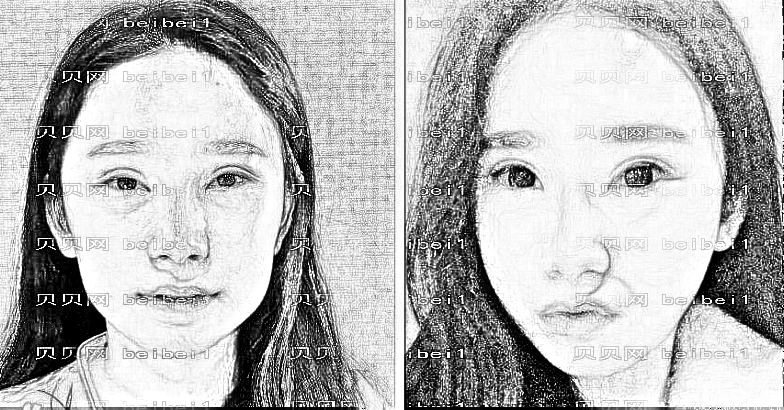 贵阳美贝尔自体脂肪填充多少钱？哪个医生技术？附介绍