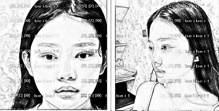昆山铂特丽去眼袋多少钱?哪个医生技术好?附,版一览
