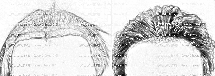长沙刘海医生植发技术怎么样？刘海医生发际线种植介绍&