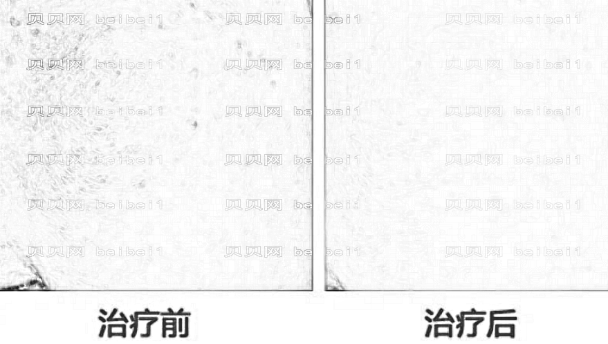 太原华美整形美容医院口碑怎么样?内附医院地址电话+