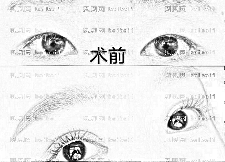 武汉艾莱美整形医院怎么样?做双眼皮技术好不好?内附介绍