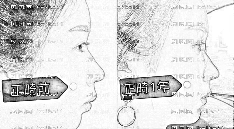深圳牙齿矫正口腔医院医生前十排名|附医院简介+,正畸