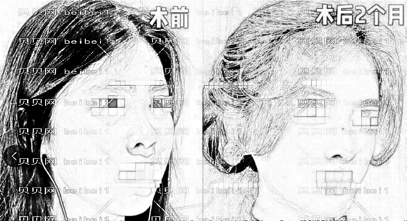 范浚泽做鼻子怎么样?范浚泽鼻型矫正技术靠谱吗?附介绍分享