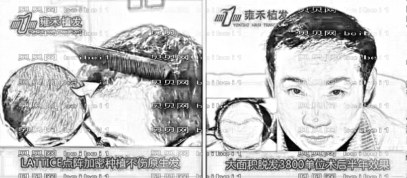 南京雍禾植发医院口碑怎么样?附医院地址电话+医生排名+