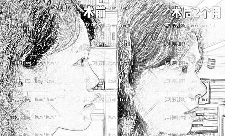 兰州隆鼻哪家医院好?揭秘兰州隆鼻医生排名前五榜单|附介绍