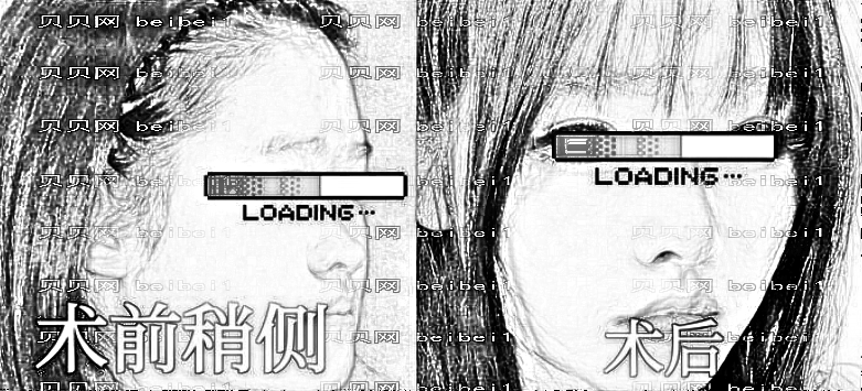 公布宁波隆鼻医生排名前十榜单|附介绍分享+隆鼻