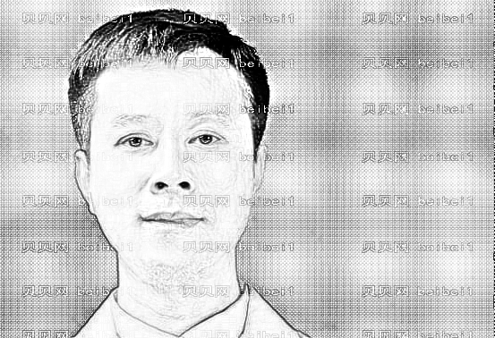 广州哪个医生做双眼皮口碑好?广州巫国辉做眼睛价格贵吗?