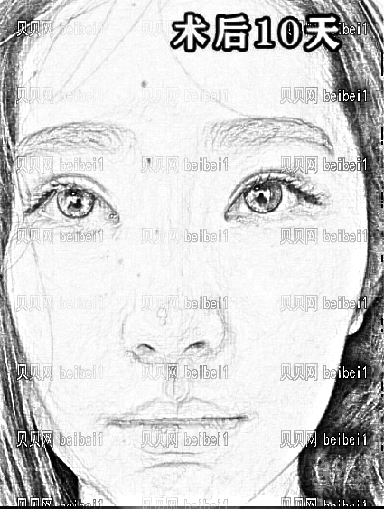 东莞西妃医疗美容医院做眼袋怎么样?东莞西妃去眼袋多少钱?