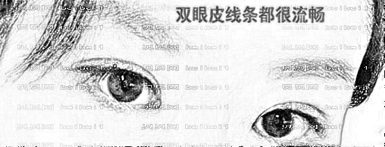 东莞非凡医疗美容医院双眼皮做得怎么样?双眼皮大概多少钱?