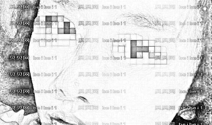 天津宋爱华医生隆鼻靠谱吗?宋爱华做鼻子价格高吗?附介绍