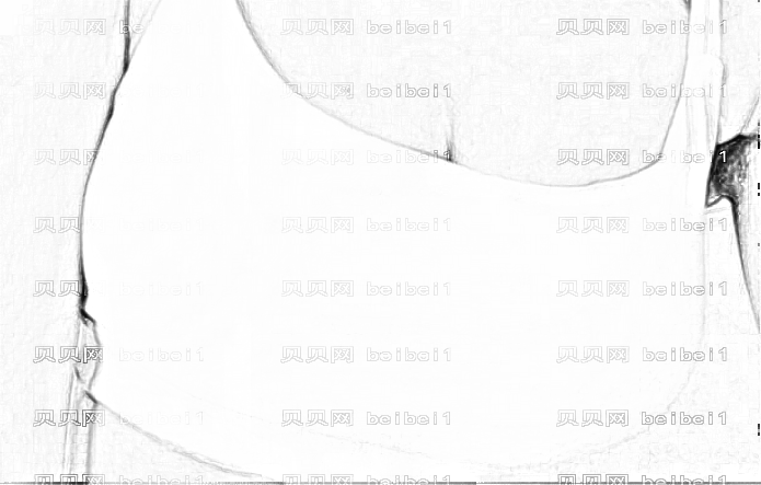 重庆徐铎脂肪丰胸果怎么样?徐铎3个月隆胸介绍分享