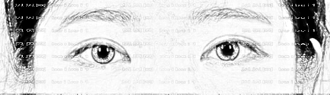 广州红十字医院矫立仁全切双眼皮技术好不好?大概多少钱?