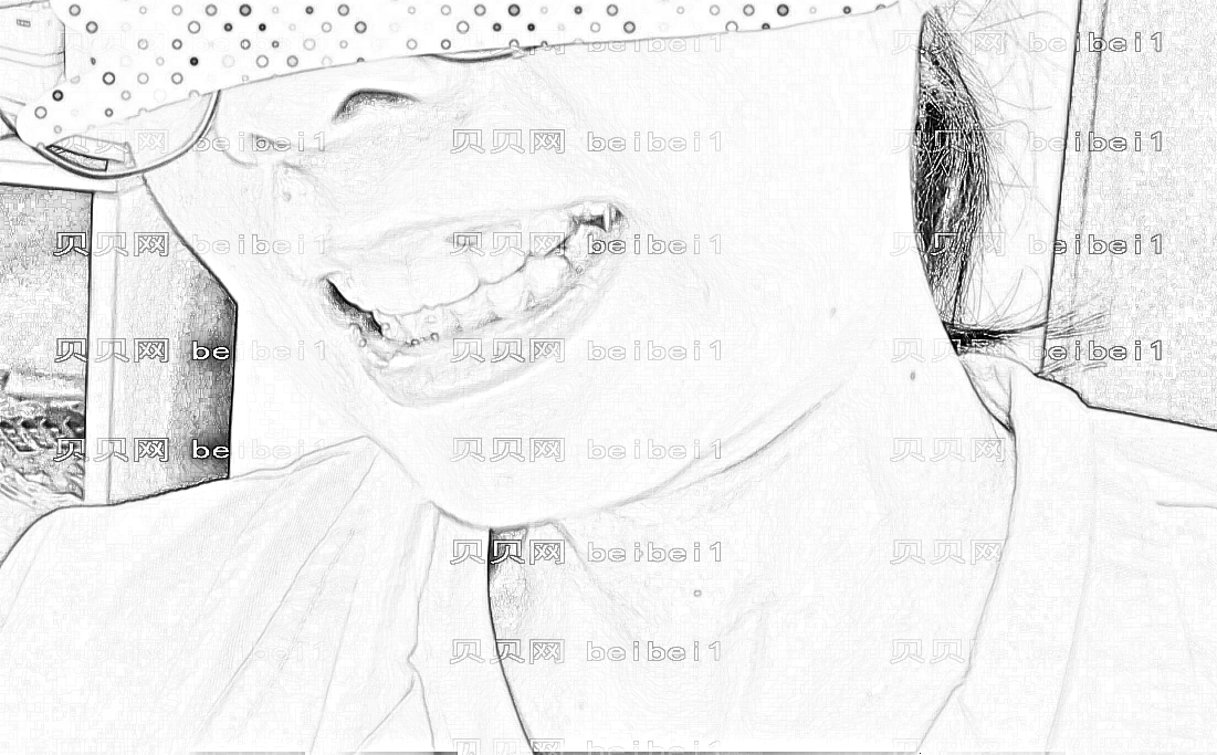 东莞博球口腔隐形牙齿矫正怎么样?东莞博球口腔9月出炉!