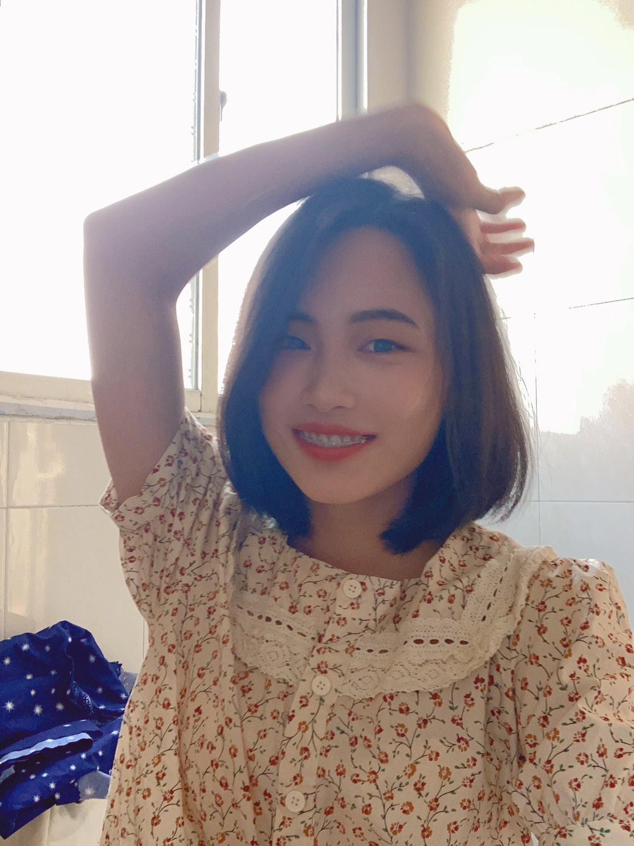 东莞仁华口腔做牙齿矫正费用多少钱?仁华口腔正畸果好不好?