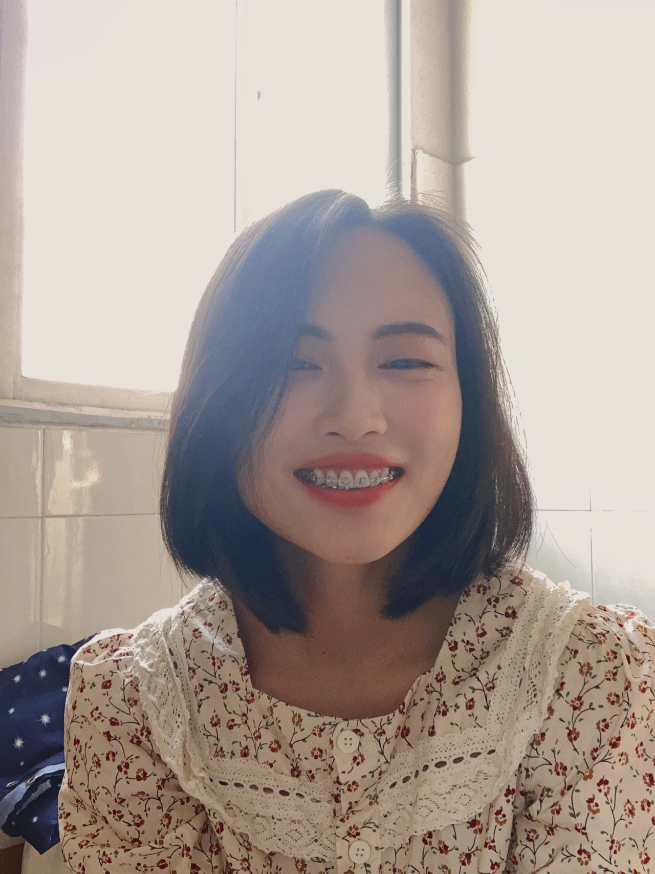 东莞仁华口腔做牙齿矫正费用多少钱?仁华口腔正畸果好不好?